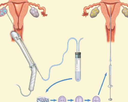 中国供卵机构排名榜单,在潍坊做试管多少钱，2025费用清单实例参考